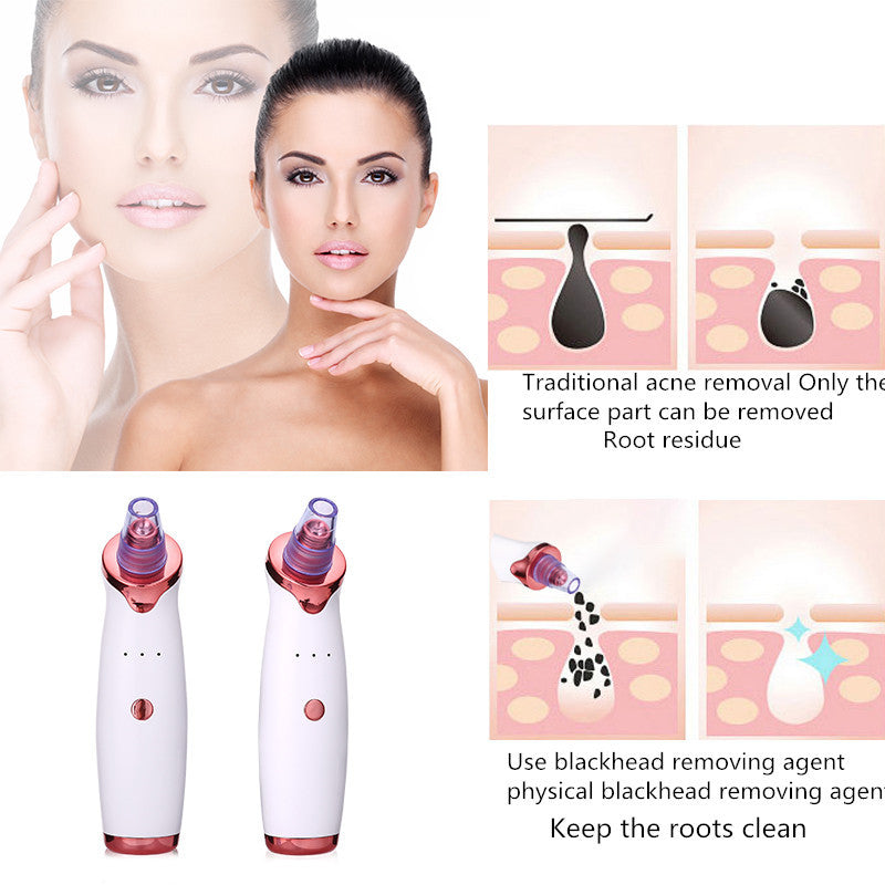 Blackhead Remover Instrument - Endless Pawsibilities