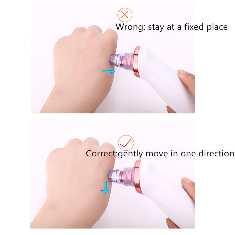 Blackhead Remover Instrument - Endless Pawsibilities